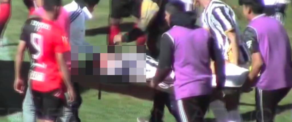 El jugador herido tuvo que ser evacuado del campo de juego en camilla a raíz de la falta que recibió.