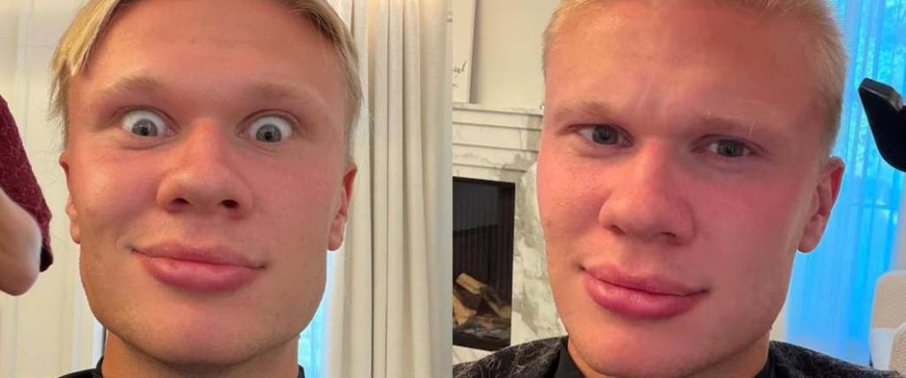 Así quedó Erling Haaland tras cambiar de look para la nueva temporada en la Premier League.