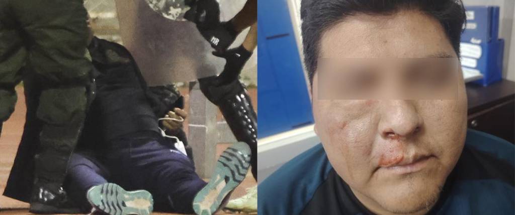 El encargado de seguridad de Blooming, Cristian Méndez, terminó con ”lesiones graves” tras pelea campal.