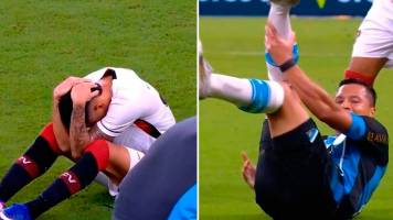 Video: ¡Con el tobillo al aire! Escalofriante lesión en el fútbol de Brasil