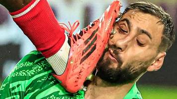 Video: El brutal golpe que recibió el arquero ‘Gigio’ Donnarumma en Francia