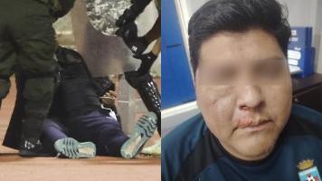 Blooming alista demandas tras “graves lesiones” por pelea campal en Oruro